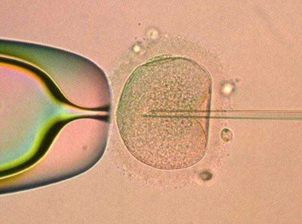 武汉供卵试管需要花多少钱 武汉正规供卵医院生殖科排名 ‘b超胚囊数据看男女